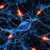 Matanza Neuronal
