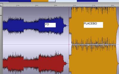Yo_Placebo.JPG