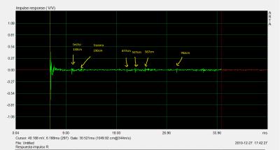 respuesta impulso R.png