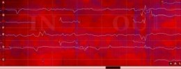 ¿El primer software de manipulación de audio polifónico?