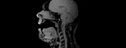 Esto es lo que pasa dentro del cuerpo de un cantante de ópera