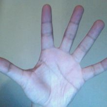 mano dub