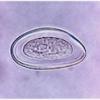 Enterobius Vermicularis