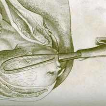 BORN WITH FORCEPS