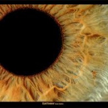 MEGAPIXEL