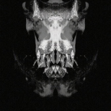 Every breath you take (darkcover de Police)
