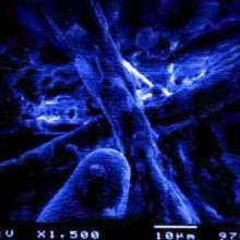 chemical burnout - symbols of technology